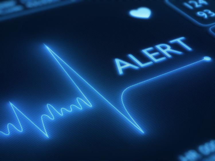 Cardioversão elétrica pode causar um “falso” supra de ST?