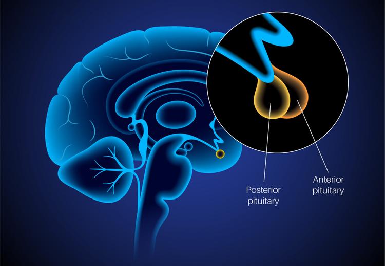 Incidentaloma Hipofisário: como manejar