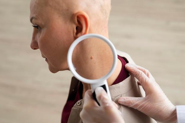 Tendência Do Melanoma Em Nível Global – Subtipo Morfológico Mudaria Prognóstico?