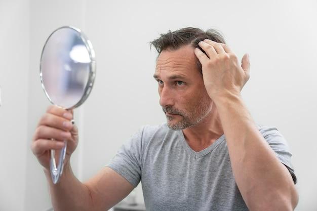O Minoxidil No Tratamento Da Alopecia Androgenética