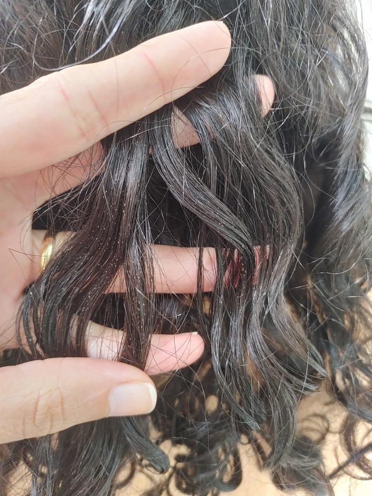 Saiba Diagnosticar E Tratar A Piedra Branca