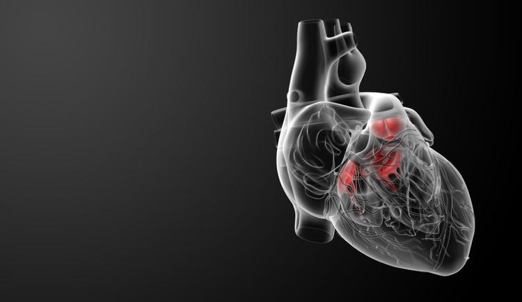 Estenose mitral sintomática durante a gestação: o que fazer?