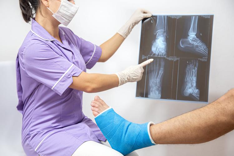 A reposição de testosterona aumenta o risco de fratura?