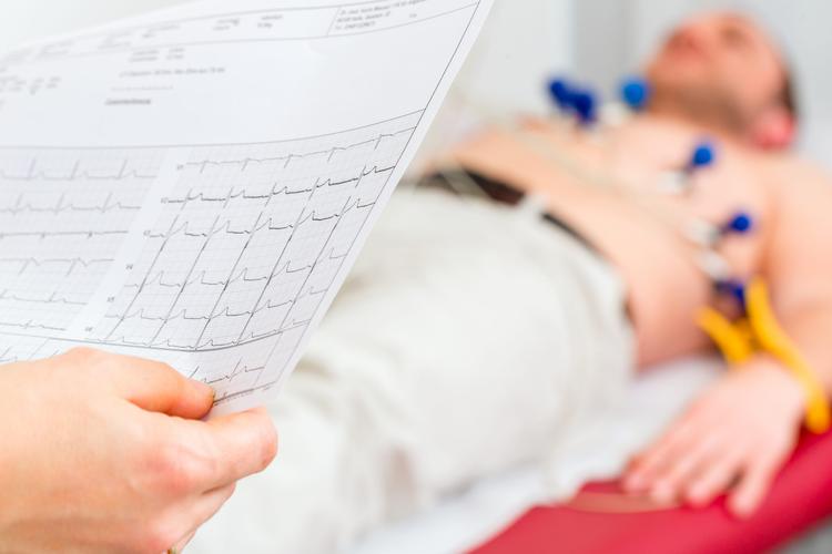 Desafio ECG: qual é o diagnóstico?