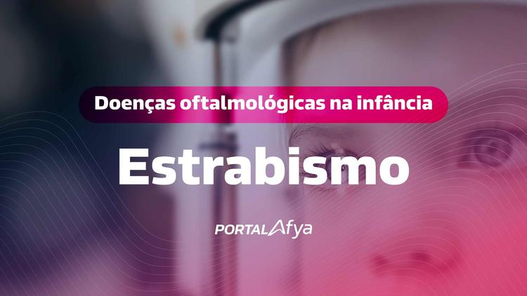 Thumbnail: Principais doenças oftalmológicas na infância: Estrabismo