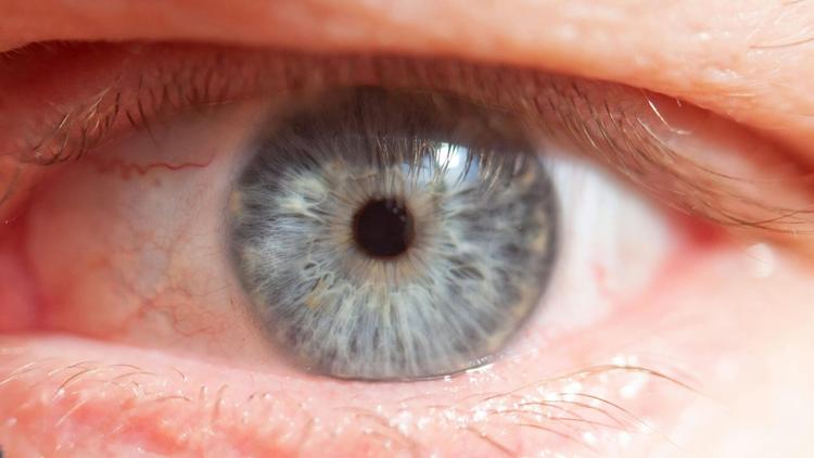 Revisão de tema: Conjuntivite Química