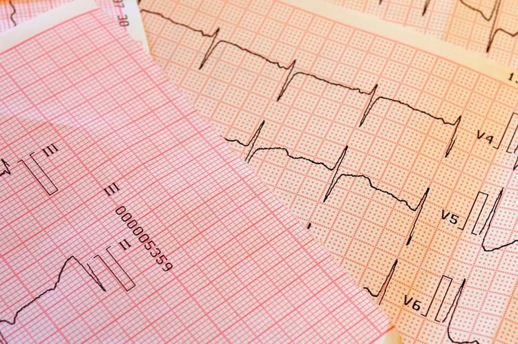 Desafio de ECG.