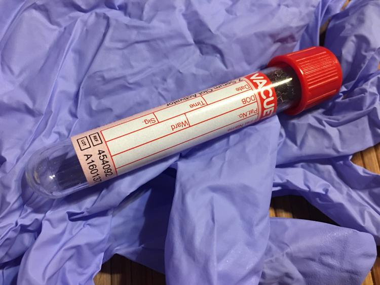 Ainda faz confusão com os conceitos de troponina ultrassensível?
