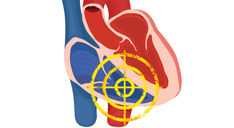 Você dá importância para a insuficiência do ventrículo direito?