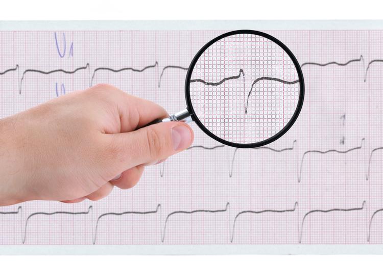 Desafio De ECG: qual a arritmia mostrada e qual o tratamento inicial?
