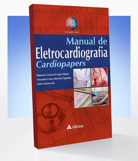 Quando mandar um paciente para angioplastia primária? Indo além do supra de ST