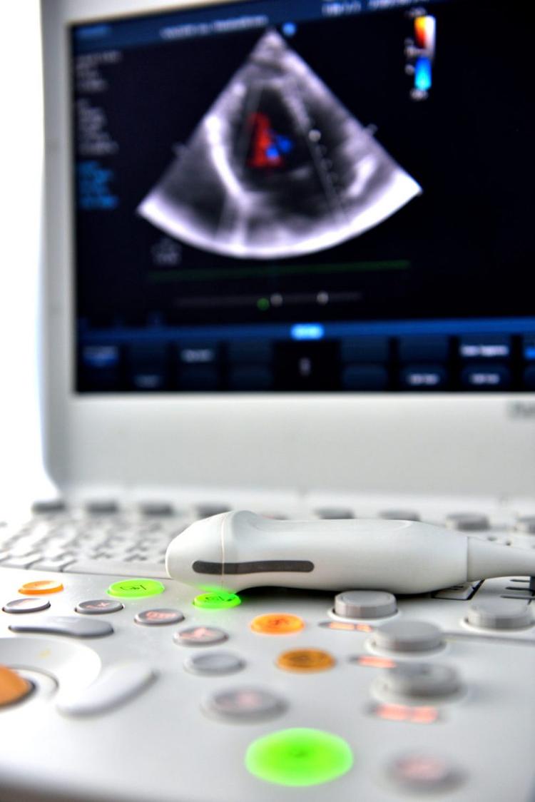 Curso básico de eco: Como estimar a fração de ejeção do ventrículo esquerdo?