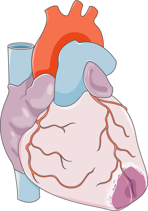 MINOCA: o que você precisa saber para diagnosticar?