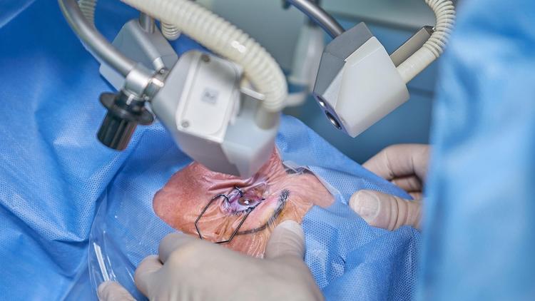 Primeiro transplante de mácula do mundo restaura visão em caso inédito