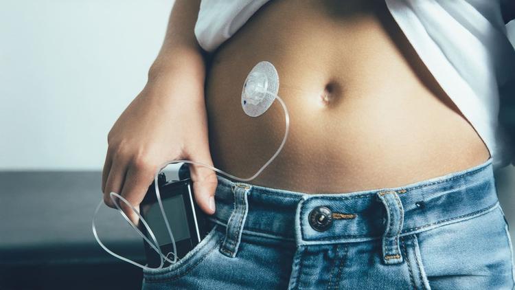 Terapia com sistema híbrido em alça fechada em jovens com HbA1c elevada