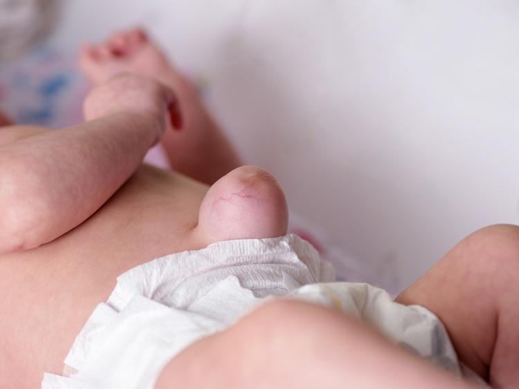 Prevalência global de anomalias congênitas