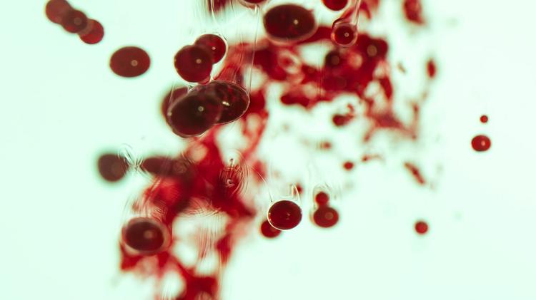 Caso clínico: hipercarbia após indução