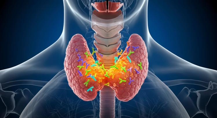 tireoidite de hashimoto