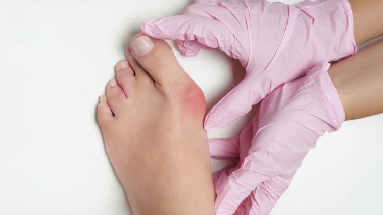 A curva de aprendizado na cirurgia percutânea para correção de joanete é maior?