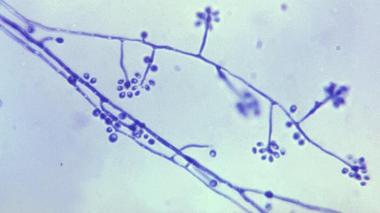 Esporotricose: uma doença negligenciada