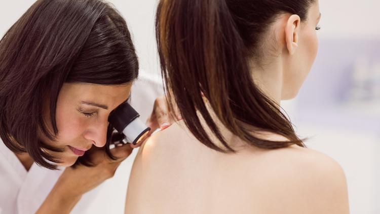 Uso da dermatoscopia no diagnóstico do carcinoma basocelular