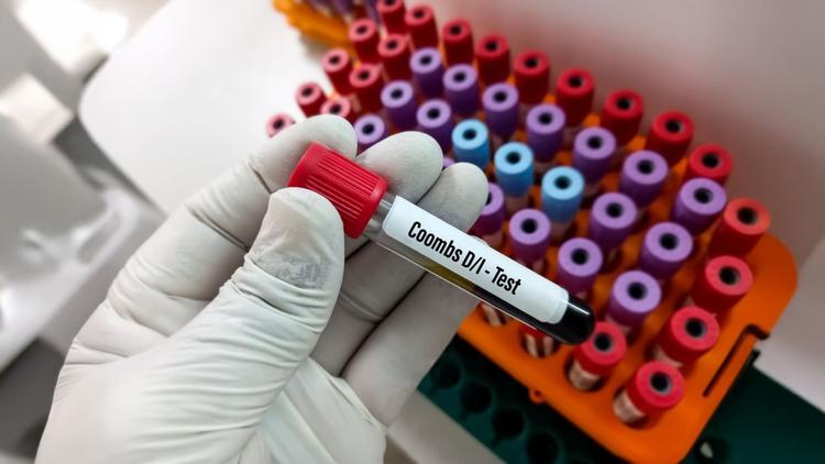 O papel do Teste de Coombs Indireto (TCI) na prática clínica