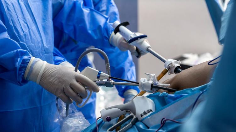 Cirurgia bariátrica: qual é a melhor técnica? Sleeve ou Bypass?