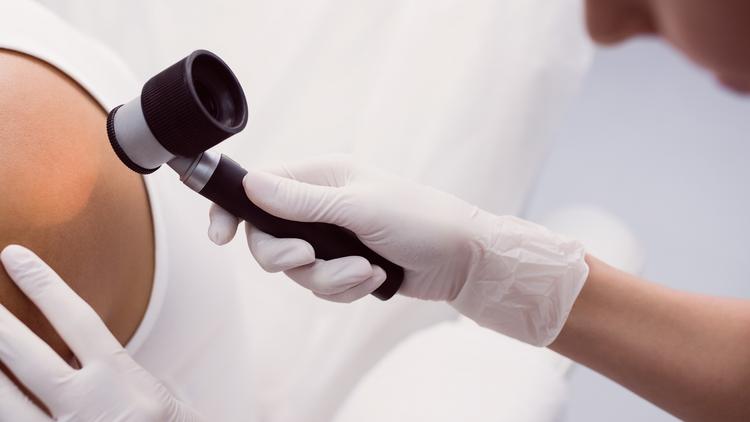 Caso clínico: “Bolinhas de sangue” pelo corpo