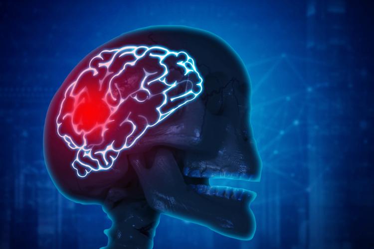 hipertensão intracraniana