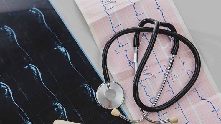 Eficácia do acoramidis no tratamento da amiloidose ATTR