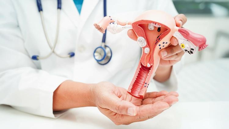 Eficácia e segurança do Afuresertib em câncer de ovário resistente à platina