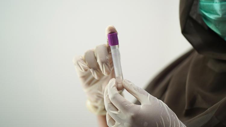 O papel da sorologia pré-transplante de órgãos sólidos