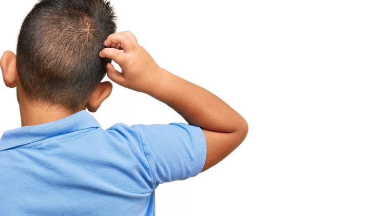 Caso clínico: Criança com lesões em couro cabeludo