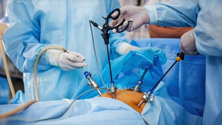 Acesso laparoscópico