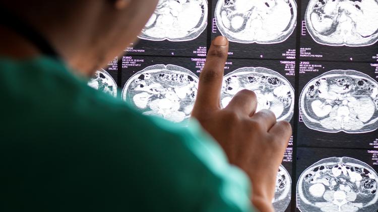 Transfusão na lesão cerebral aguda: atualização das evidências disponíveis