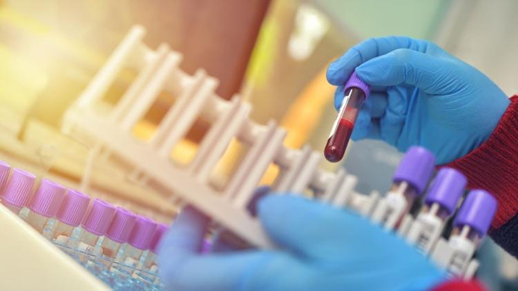 EHA 2025 - Ziftomenibe + quimioterapia