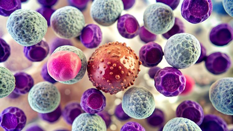 EHA 2025: Dasatinibe em associação à quimioterapia na LMA com mutação CBF