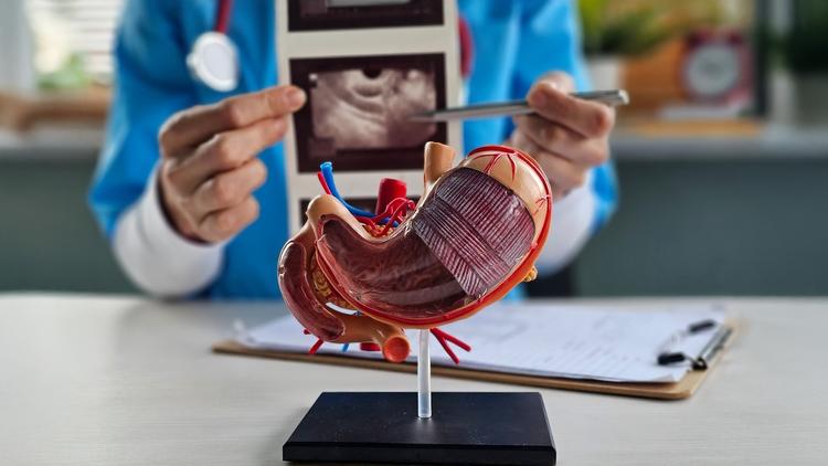 Cistadenoma seroso do pâncreas