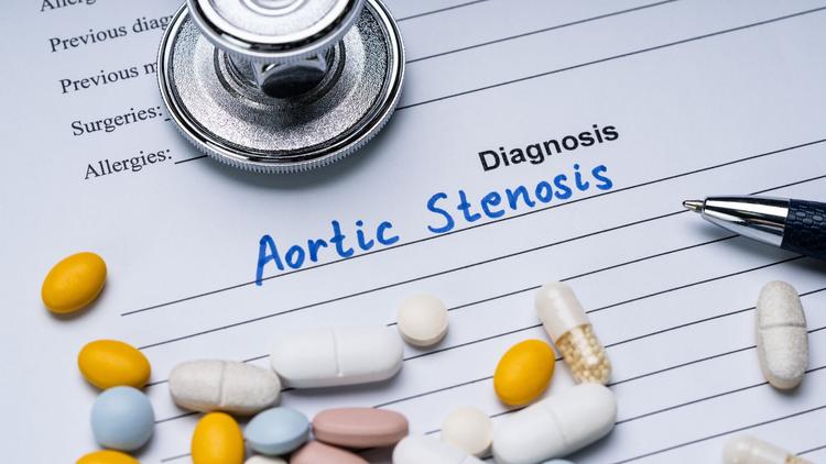 EARLY TAVR: novas evidências para o tratamento da estenose aórtica importante assintomática