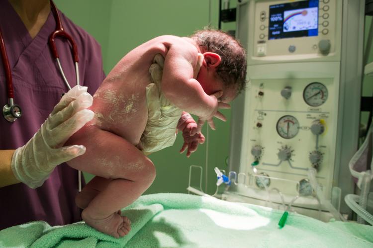 Fibrose Cística no Período Neonatal