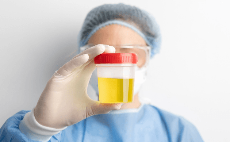 Normetanefrina urinária como marcador de mortalidade em incidentalomas adrenais