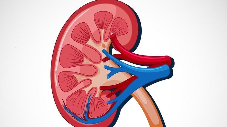 Mais de 10 mil pessoas morreram por câncer renal em três anos