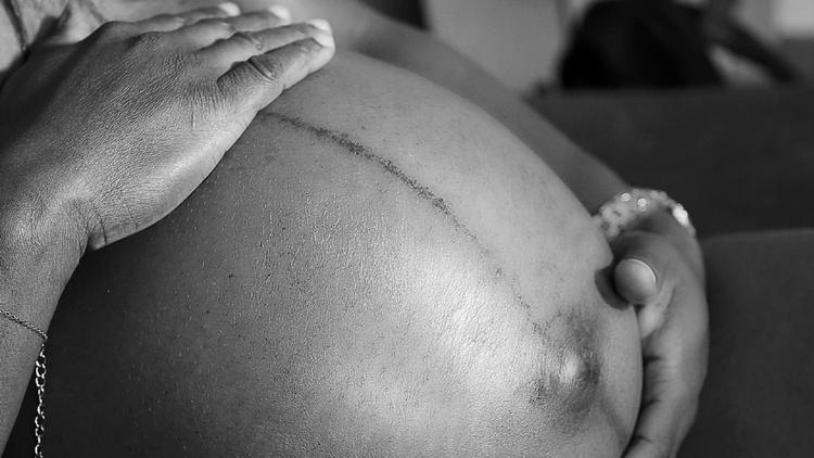 FMF World Congress 2025: Colestase gestacional em paciente em uso de azatioprina