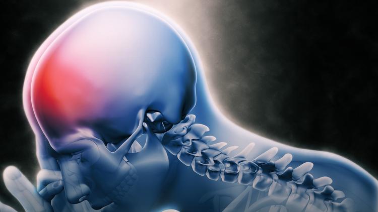 Meningite: o que dizem as novas diretrizes?