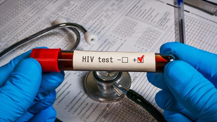 IAS 2025: Novas recomendações OMS para profilaxia pós-natal de HIV e Mpox