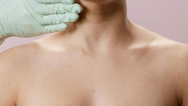 Caso clínico: Paciente com lesões anulares pelo tronco. Qual o diagnóstico?