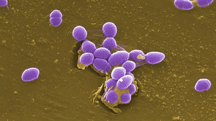 Endocardite infecciosa: Escore de risco em infecções por enterococo