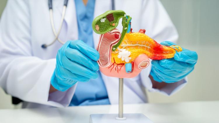 CBC 2025: Melhorando os resultados na cirurgia do pâncreas