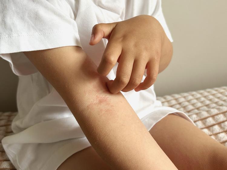 Dermatologia Pediatrica