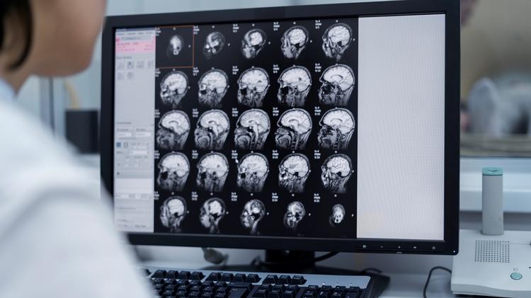 Estudo recente compara TC de crânio com angioTC ou TC com perfusão